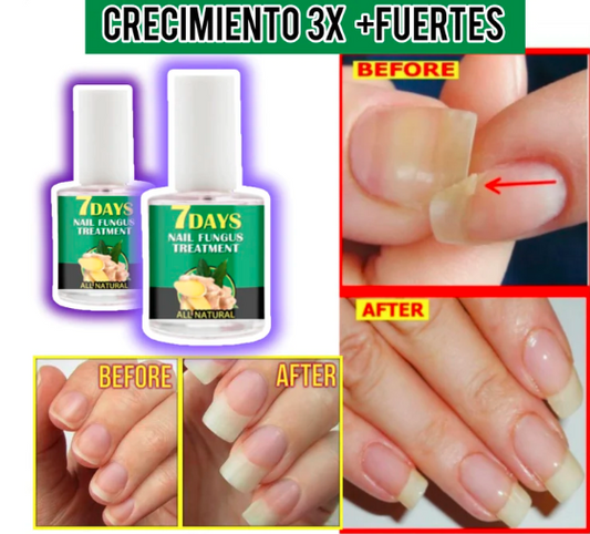 Serum de Endurecedor de Uñas